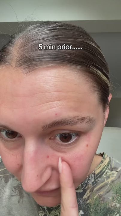 Orea Firm+ Eye Tightening Cream video